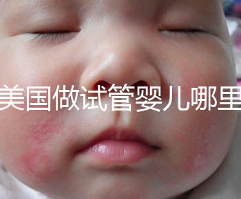 去美國做試管嬰兒哪里最好，4家好評輔助生殖機構推薦