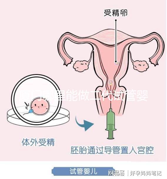 廈門哪里能做二代試管嬰兒，做一次成功率和費用多少？