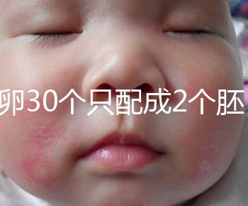取卵30個只配成2個胚胎別放棄!卵巢傷口小移植成功率不低