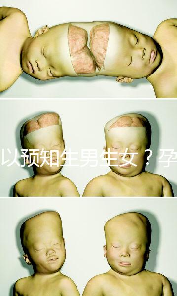 可以預(yù)知生男生女？孕婦夢見馬的胎夢解讀