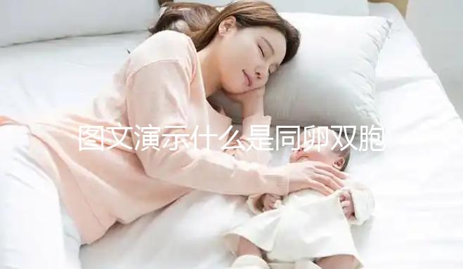 圖文演示什么是同卵雙胞胎,和異卵雙胞胎有3大區別