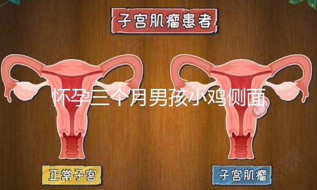 懷孕三個月男孩小雞側(cè)面二維b超圖片分享，原來兩腿間有尖