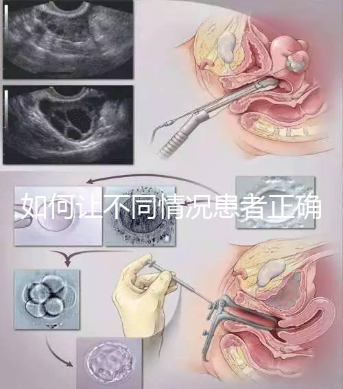 如何讓不同情況患者正確進行人工授精,看看相因醫生怎么說