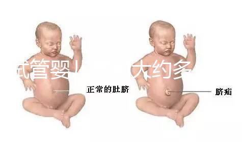 試管嬰兒費用大約多少2021年:國內(nèi)試管之(10)額外可能需要費用: