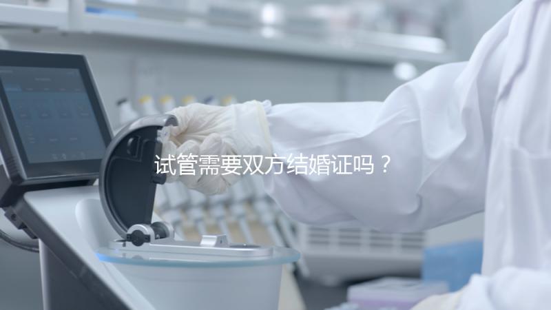 試管需要雙方結婚證嗎？試管是不是需要結婚證