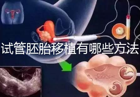 試管胚胎移植有哪些方法？