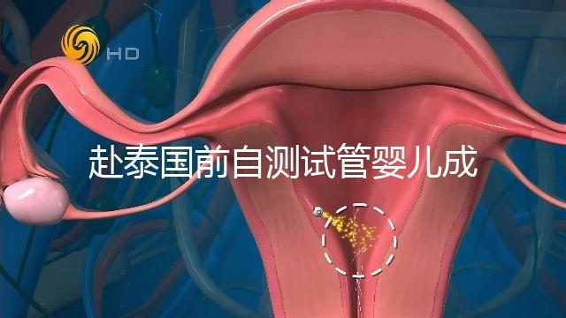 赴泰國前自測(cè)試管嬰兒成功率,這些方法值得收藏