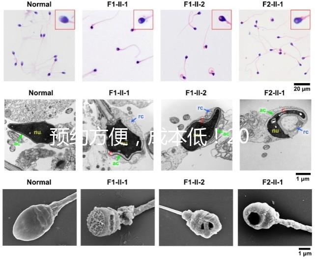 預約方便，成本低！2024年西安新城、臨潼、雁塔四維彩超指南