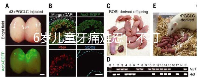 6歲兒童牙痛難忍，不打針吃藥5個小妙招快速止疼