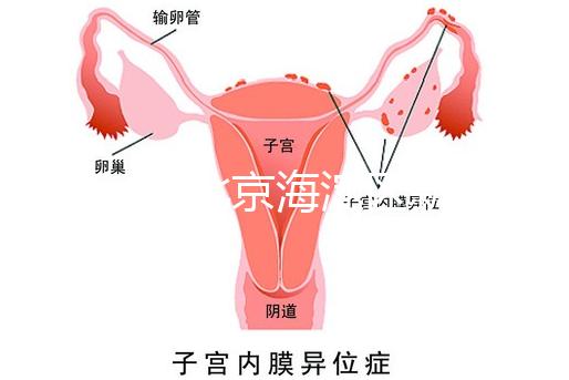 2024年北京海淀區新生兒醫療保險處理策略，照片要求不要出錯