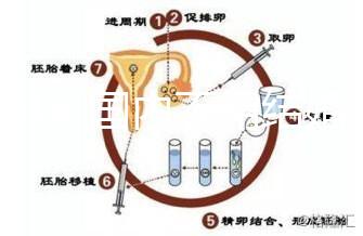 2024年國內不用結婚證做試管嬰兒的醫(yī)院排名一覽