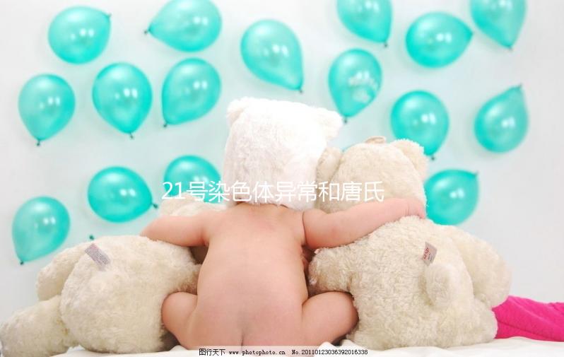 21號染色體異常和唐氏綜合癥關(guān)系不小，你肯定知道