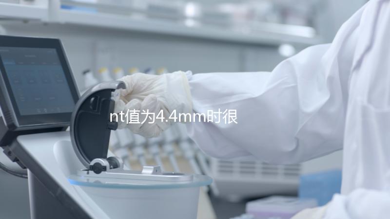 nt值為4.4mm時(shí)很危險(xiǎn),及時(shí)羊穿確認(rèn)胎兒畸形很重要